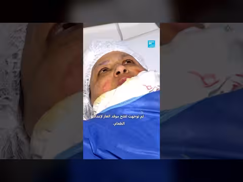 بنك جلدي مصري يعيد الأمل للمصابين بحروق