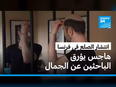 الصلع بين الرجال في فرنسا