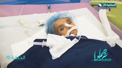 الطفلة سلسبيل تعاني من سؤ التغذية تحتاج للمساعدةبالشفاء العاجل تراحموا