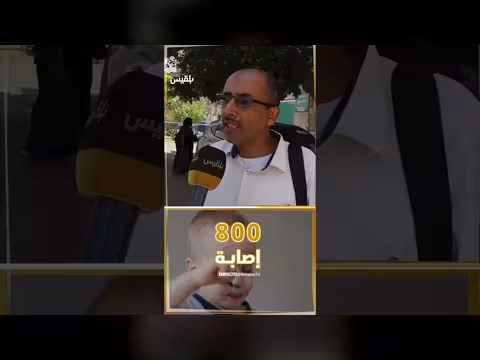 انتشار فيروس الحصبة في اليمن