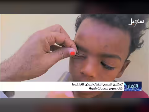 تدشين مسح طبي لمرض التراخوما في شبوة