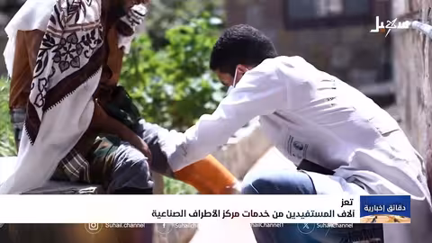 تعز.. آلاف المستفيدين من خدمات مركز الأطراف الصناعية