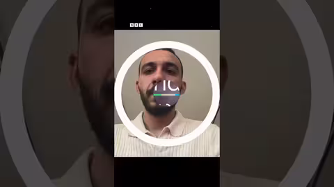 طفلة جزائرية تستعيد المشي بعد علاج في مصر.. تعليق الطبيب